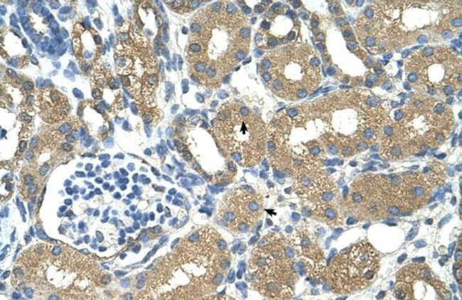 ADH4 Antibody in Immunohistochemistry (IHC)