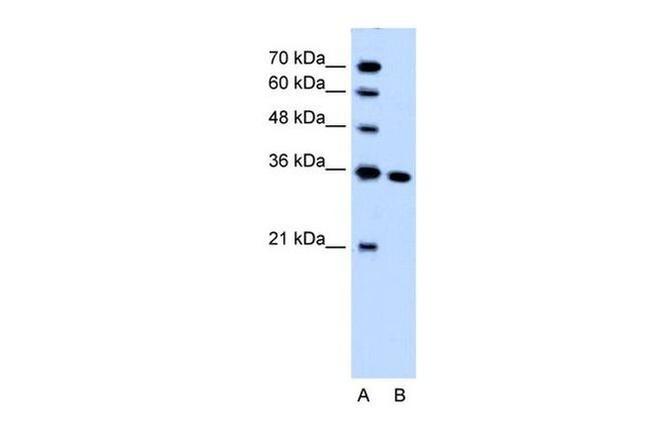 SLC25A29 Antibody in Western Blot (WB)