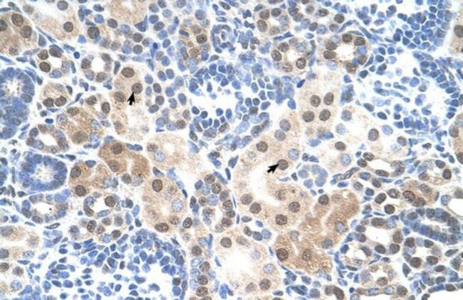 SLC25A45 Antibody in Immunohistochemistry (IHC)