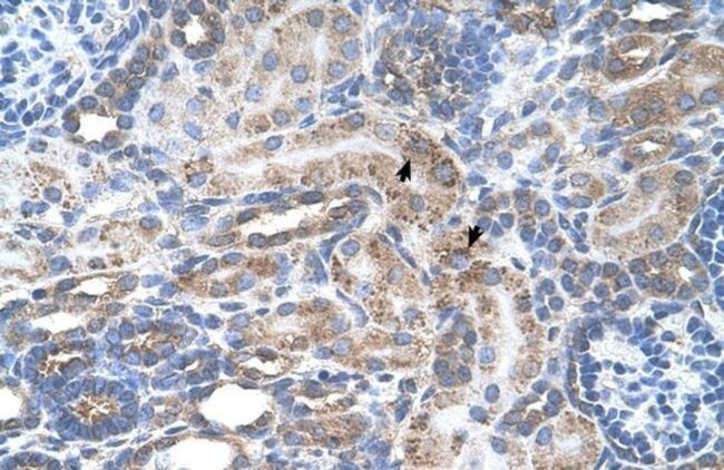 ENT2 Antibody in Immunohistochemistry (IHC)