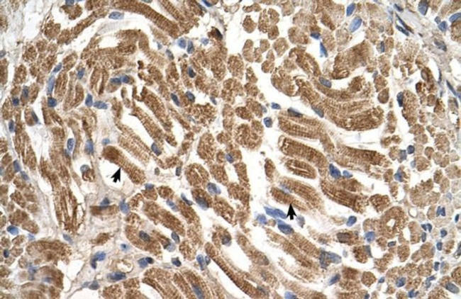 SLC17A5 Antibody in Immunohistochemistry (IHC)