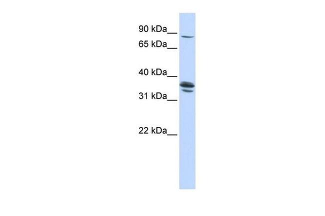 SLCO3A1 Antibody in Western Blot (WB)