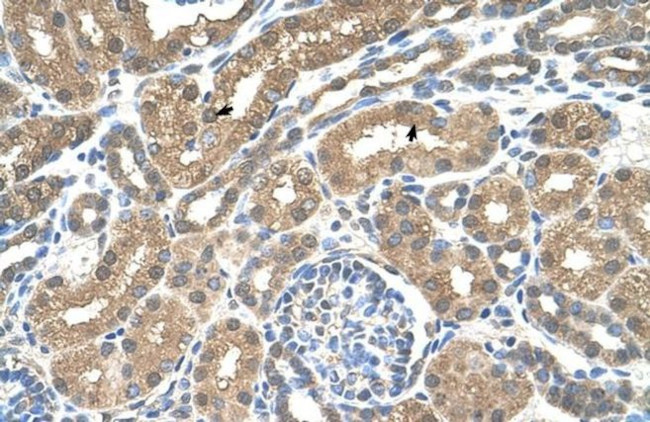 SLC16A8 Antibody in Immunohistochemistry (IHC)