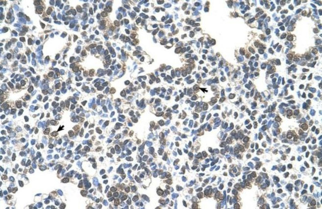 SLC43A3 Antibody in Immunohistochemistry (IHC)