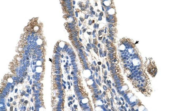 SLC25A39 Antibody in Immunohistochemistry (IHC)