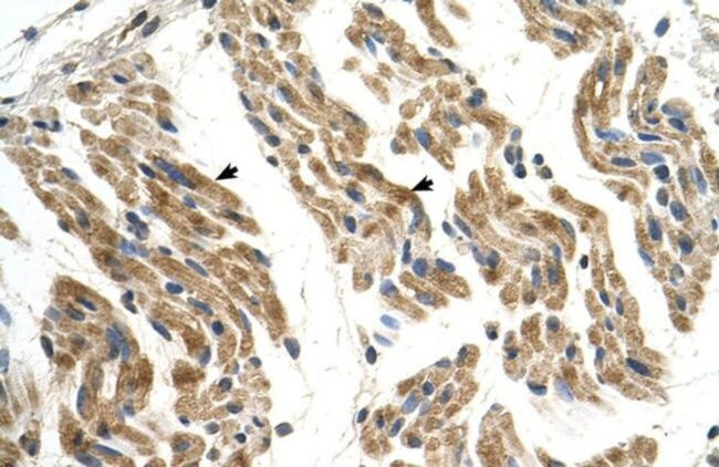 SLC35F2 Antibody in Immunohistochemistry (IHC)