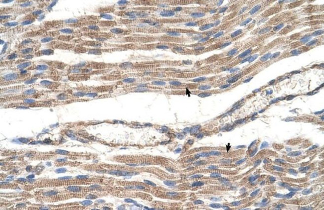 SLC2A6 Antibody in Immunohistochemistry (IHC)