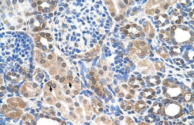 SLC7A14 Antibody in Immunohistochemistry (IHC)