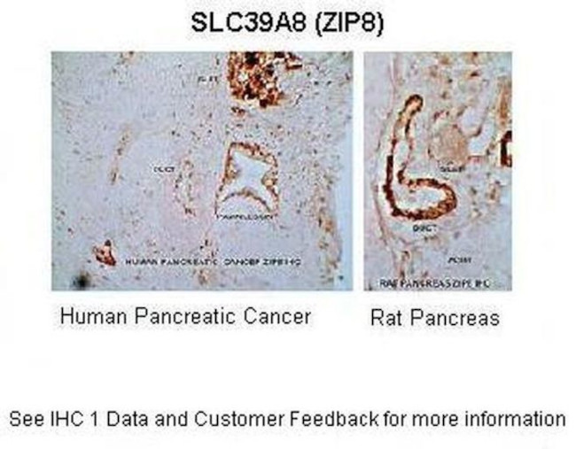 SLC39A8 Antibody in Immunohistochemistry (IHC)