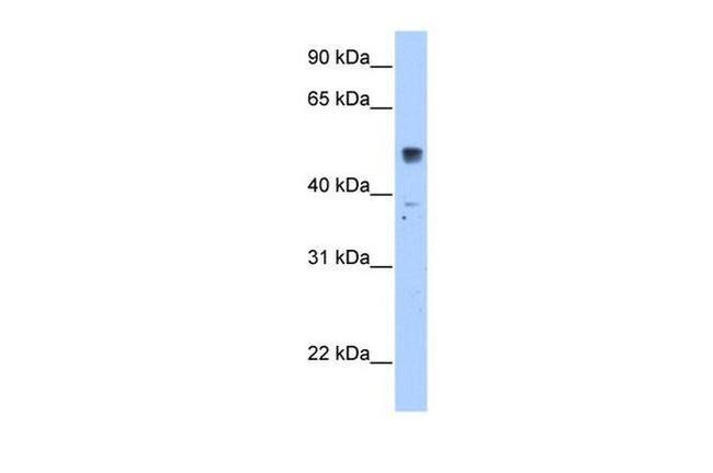 SLC35F5 Antibody in Western Blot (WB)