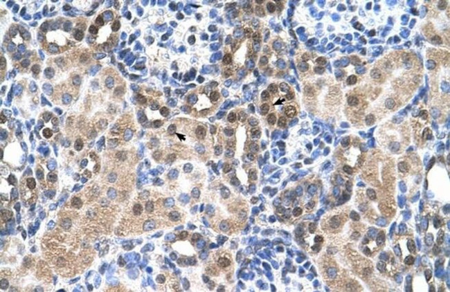 SLC46A3 Antibody in Immunohistochemistry (IHC)