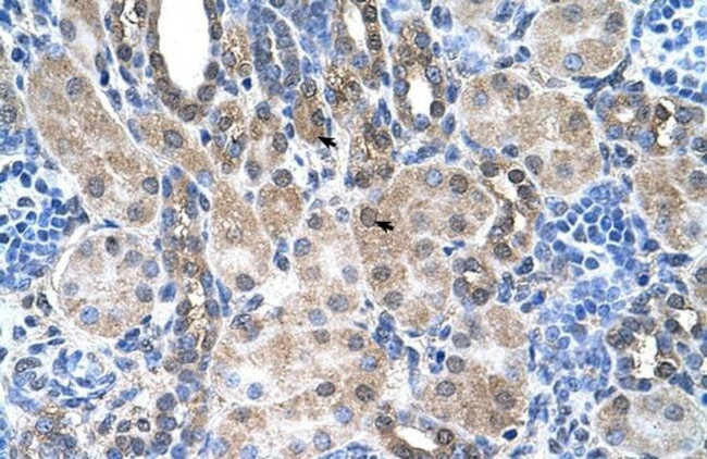 SLC6A18 Antibody in Immunohistochemistry (IHC)