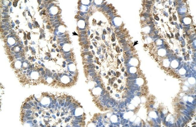 C8B Antibody in Immunohistochemistry (IHC)