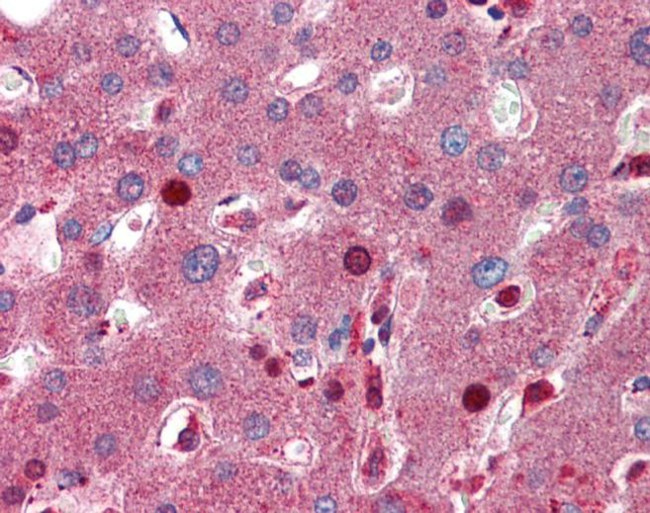 C8B Antibody in Immunohistochemistry (IHC)