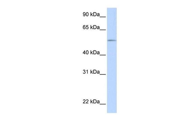 UGT1A1 Antibody in Western Blot (WB)