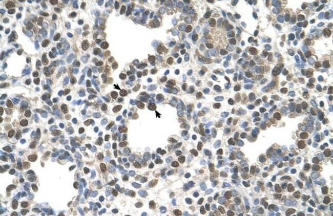 ZDHHC13 Antibody in Immunohistochemistry (IHC)