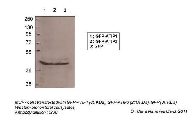 MTUS1 Antibody in Western Blot (WB)