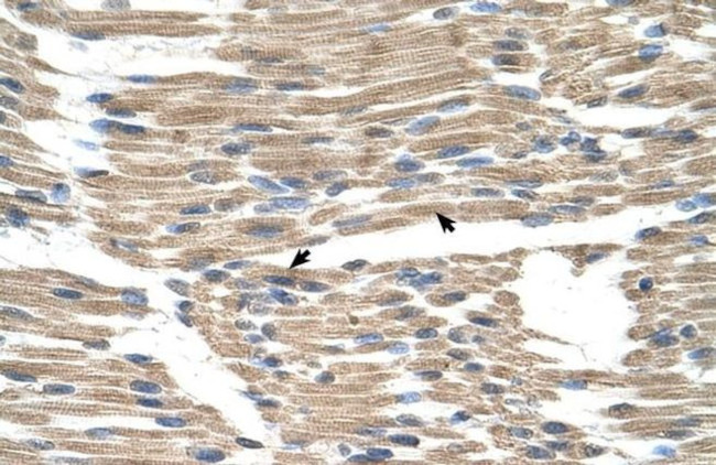 GPR177 Antibody in Immunohistochemistry (IHC)