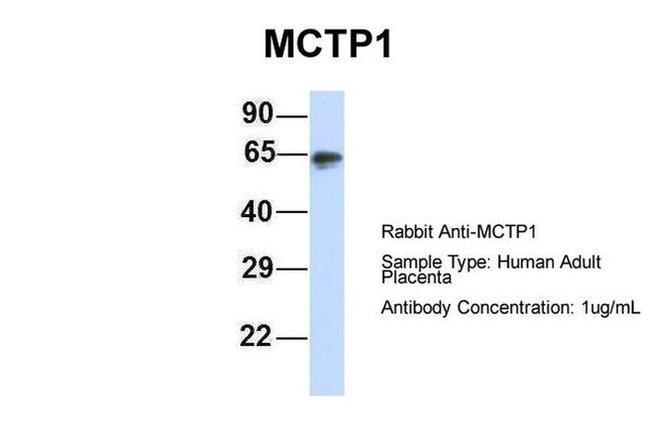 MCTP1 Antibody in Western Blot (WB)
