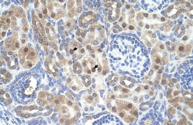 ARMCX6 Antibody in Immunohistochemistry (IHC)