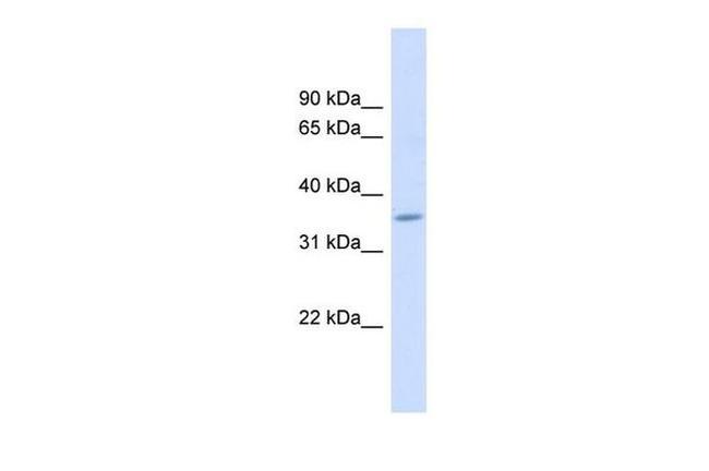 FAM26F Antibody in Western Blot (WB)
