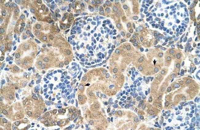 TM9SF1 Antibody in Immunohistochemistry (IHC)