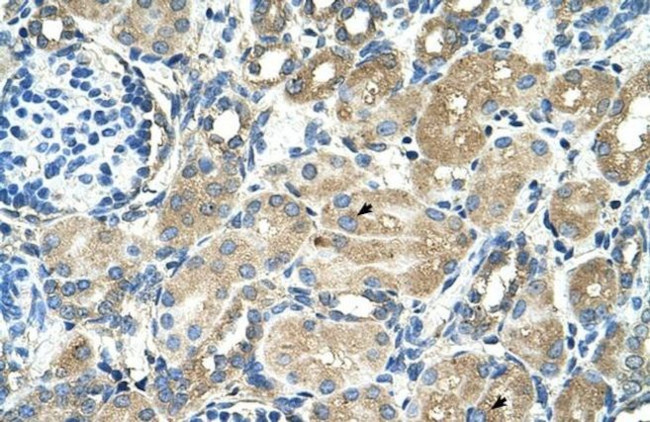 TM9SF1 Antibody in Immunohistochemistry (IHC)
