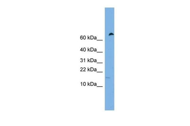 IFITM5 Antibody in Western Blot (WB)