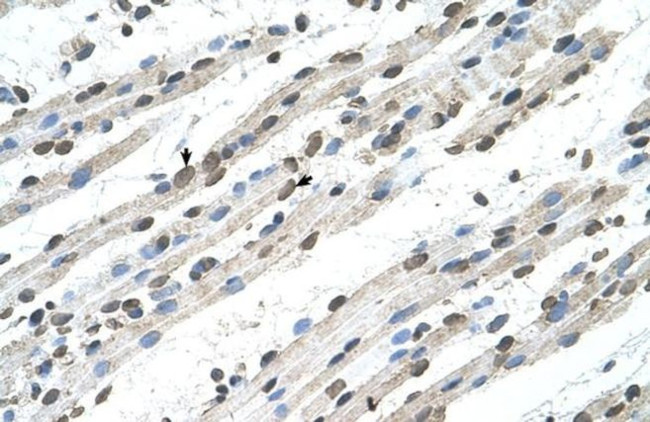 RCE1 Antibody in Immunohistochemistry (IHC)