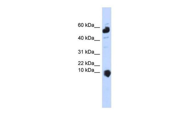 C1orf151 Antibody in Western Blot (WB)