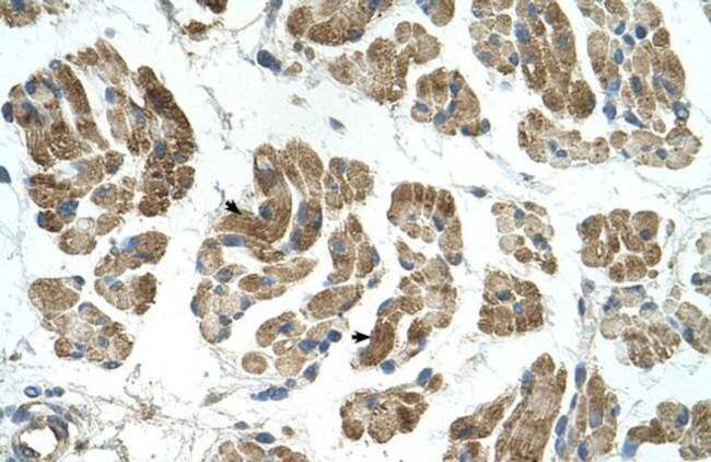 RHOT1 Antibody in Immunohistochemistry (Paraffin) (IHC (P))
