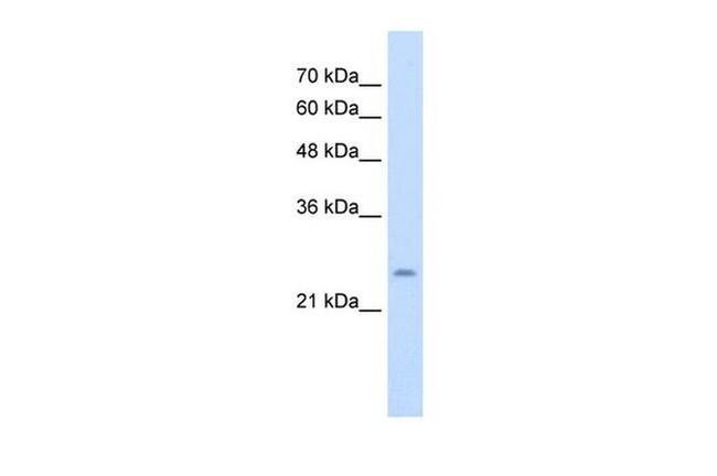 CHIC1 Antibody in Western Blot (WB)