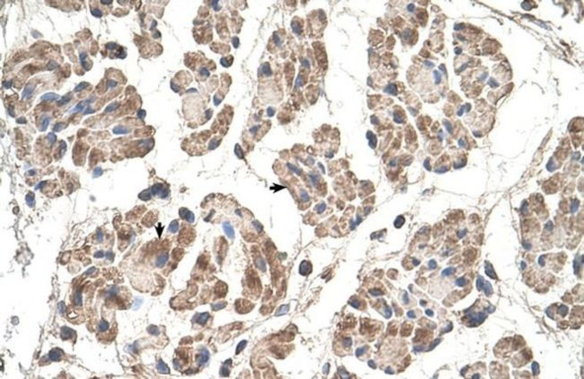 MOSPD3 Antibody in Immunohistochemistry (IHC)