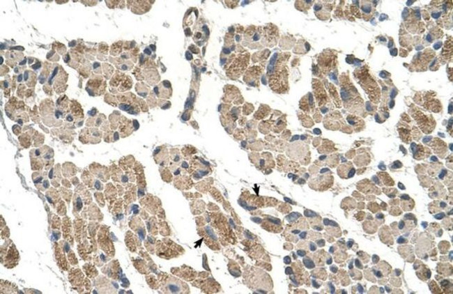 CLCC1 Antibody in Immunohistochemistry (IHC)