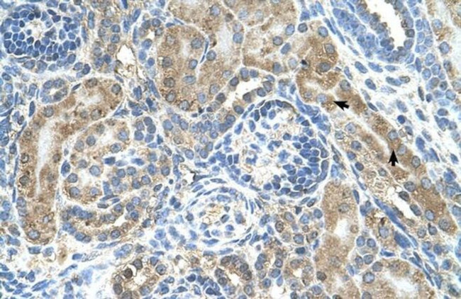 CRELD1 Antibody in Immunohistochemistry (IHC)