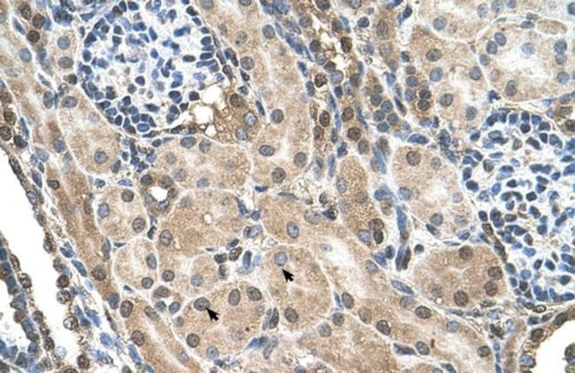 TMEM231 Antibody in Immunohistochemistry (IHC)