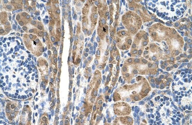 FAM55D Antibody in Immunohistochemistry (IHC)