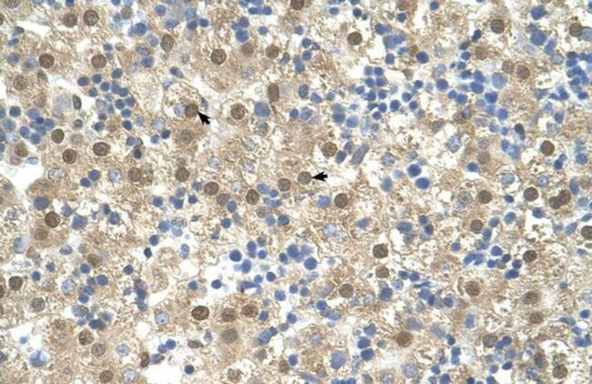 TETRAN Antibody in Immunohistochemistry (IHC)