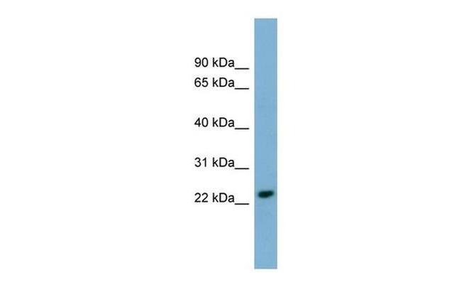 NKG2E Antibody in Western Blot (WB)