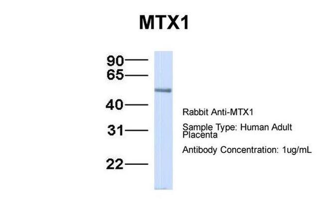 MTX1 Antibody in Western Blot (WB)
