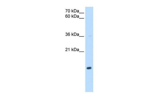 NDUFB5 Antibody in Western Blot (WB)