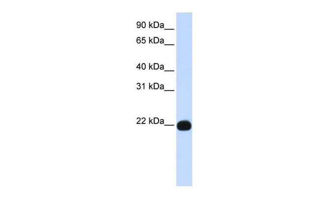 PIGA Antibody in Western Blot (WB)
