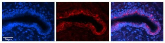 Ribophorin II Antibody in Immunohistochemistry (Paraffin) (IHC (P))