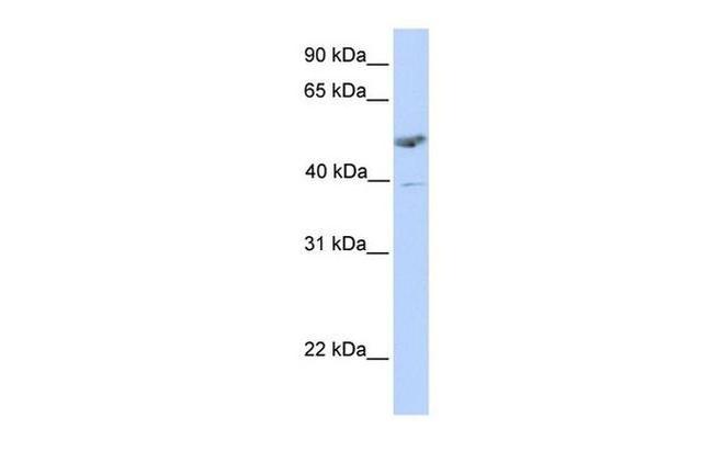 ST3GAL1 Antibody in Western Blot (WB)