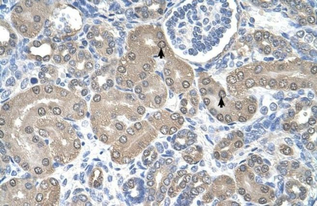 TRAP alpha Antibody in Immunohistochemistry (IHC)