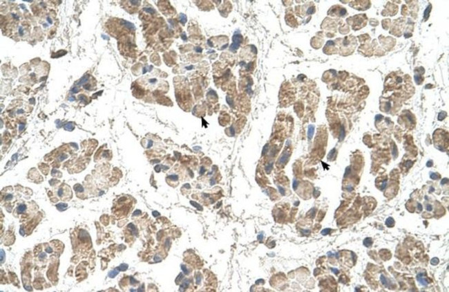 SSR2 Antibody in Immunohistochemistry (IHC)