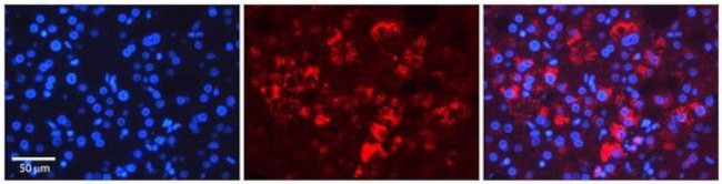 Tapasin Antibody in Immunohistochemistry (Paraffin) (IHC (P))