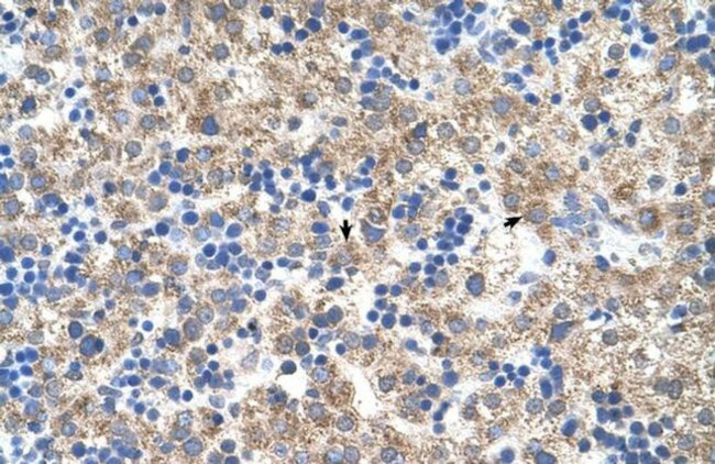 MB67 Antibody in Immunohistochemistry (IHC)