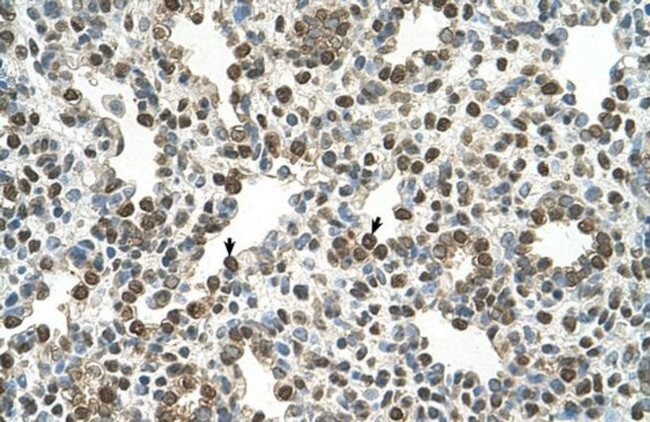 ORP9 Antibody in Immunohistochemistry (IHC)