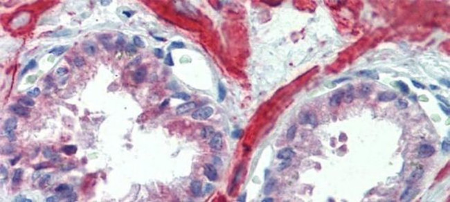 IGFBP4 Antibody in Immunohistochemistry (IHC)
